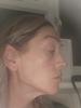 Right side of my face