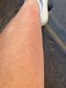 Soft skin