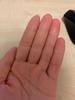 My hand after using the cream for a week. It used to be very dry and the skin was peeling off