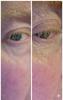 After and before