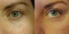 Before and after