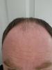 After using for a week with very sensitive dry sky