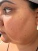 Left side of face