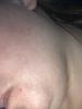 Nourished skin