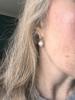Age spots