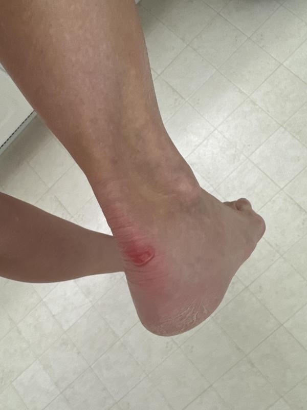 Photo submitted with review of product