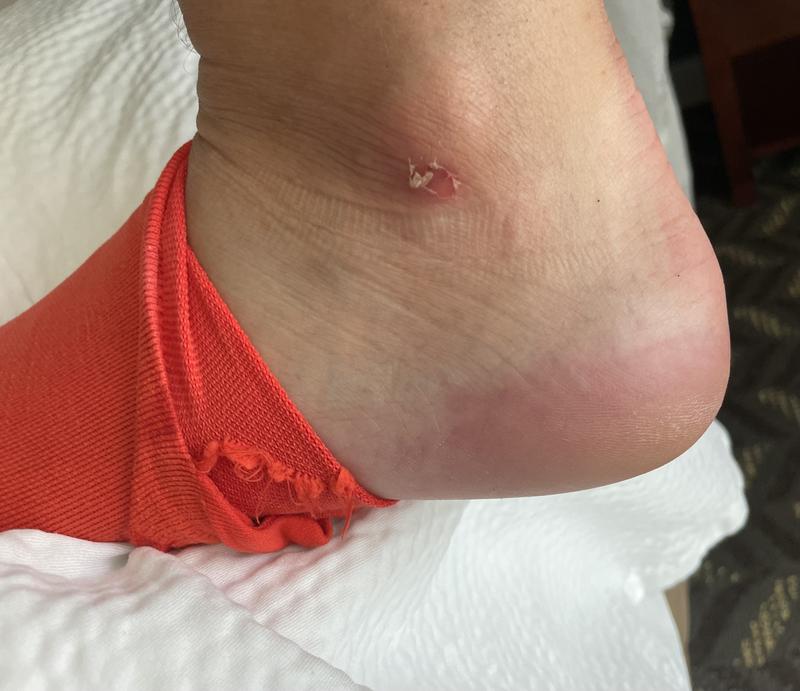 Photo submitted with review of product