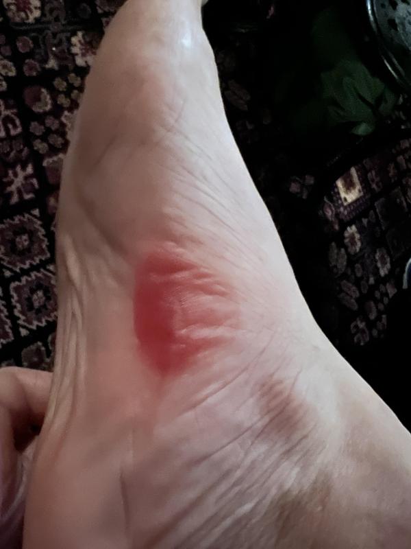Photo submitted with review of product