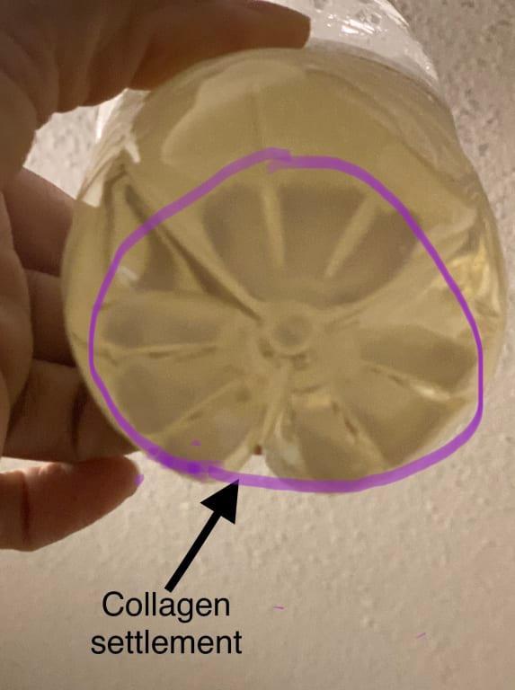 Customer photo for "Collagen is the most abundant protein in your body"