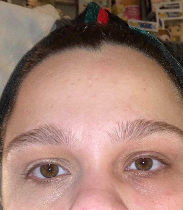 Left side has the concealer and the right does not to show coverage
