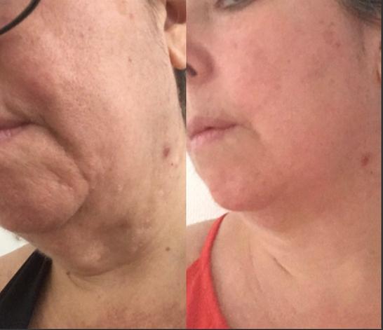 Customer photo for "Exceeded my expectations."