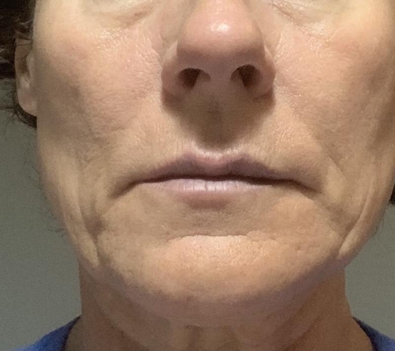 Review Thumbnail Image 0 256656856