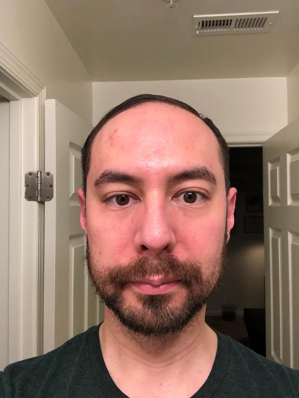 Customer photo for "Produces Results as Advertised"