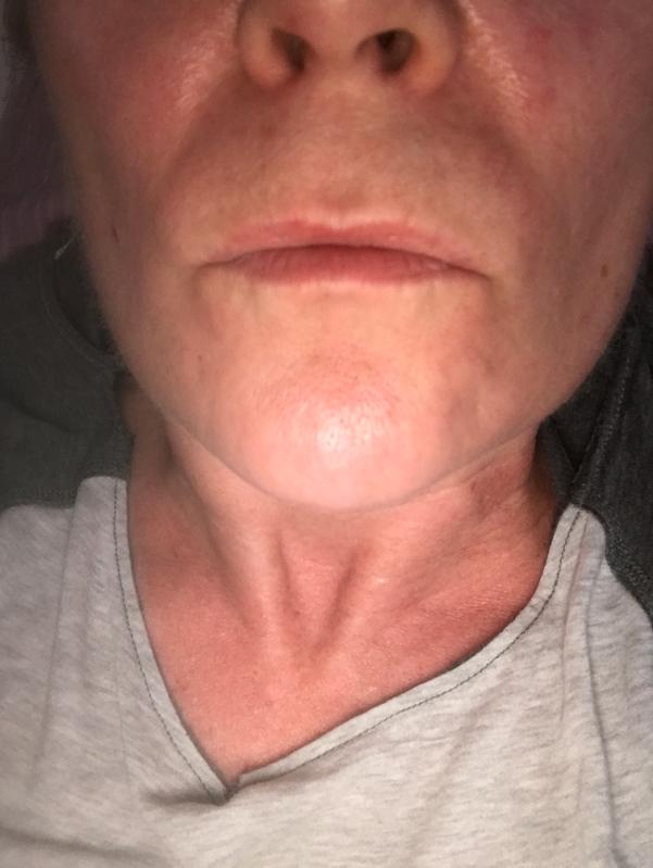 It’s the right side ! Your left . One time !!