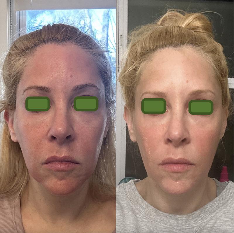 One Month Difference!