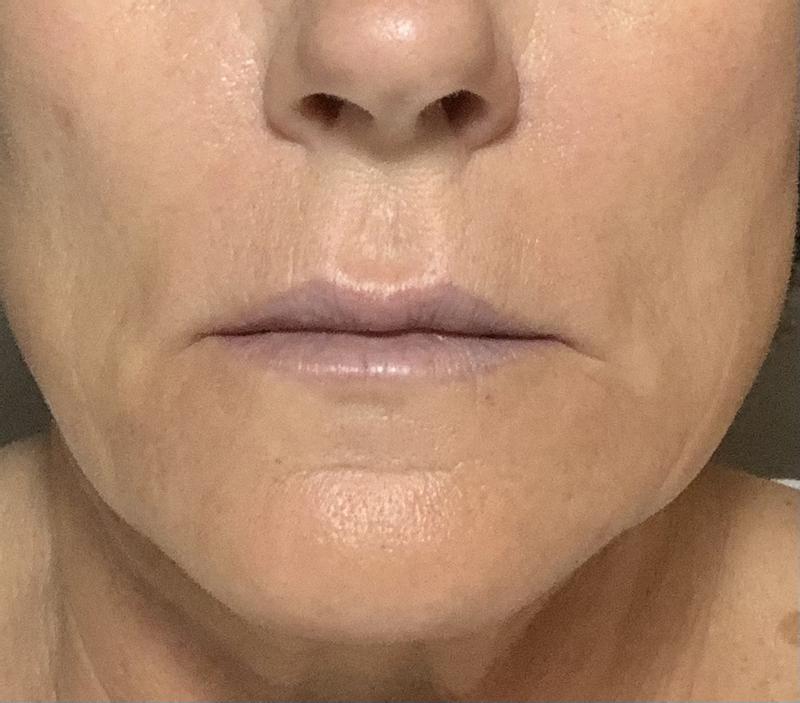 Review Thumbnail Image 1 256656856