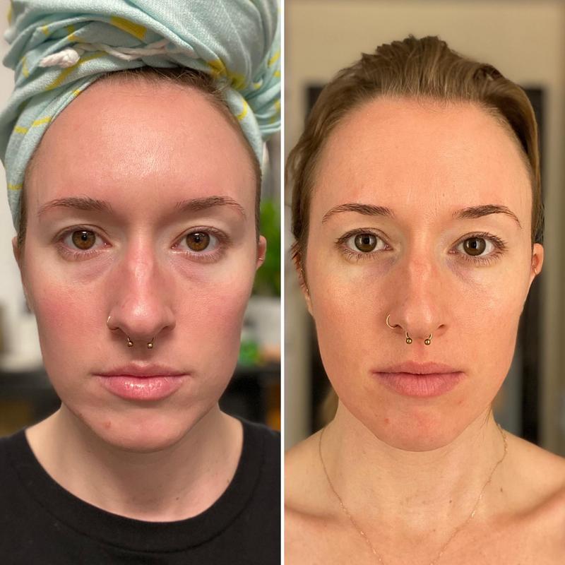 Unedited photos, same time of day and location 7 days later