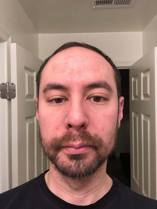Customer photo for "Produces Results as Advertised"