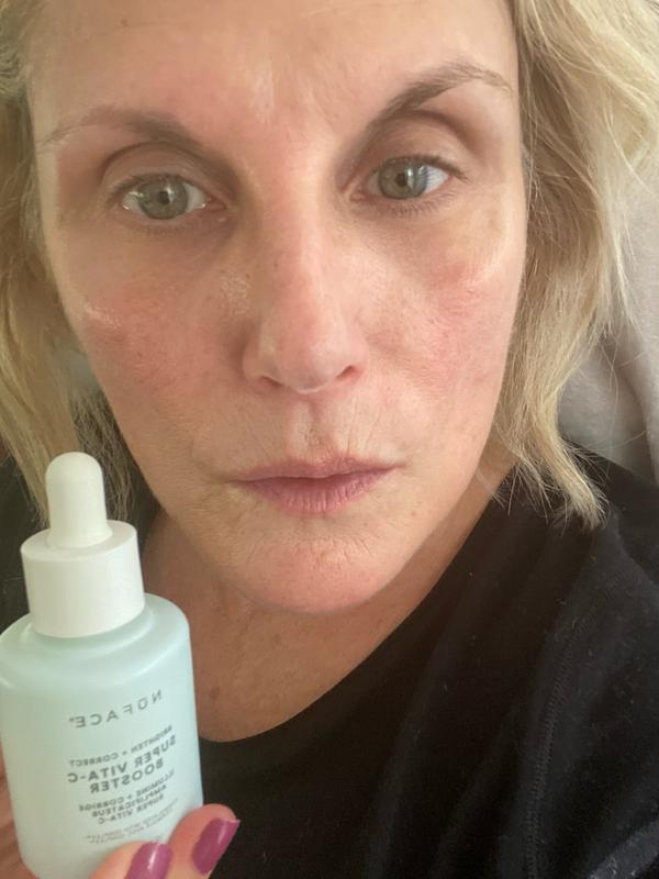 Vitamin C. I love it ♥️