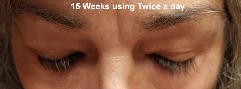 Customer photo for "Best lash and brow growth serums I have tried."