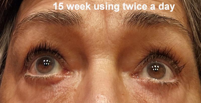 Customer photo for "Best lash and brow growth serums I have tried."