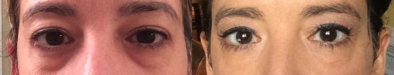 left-zero makeup; right-this awesome concealer!!!