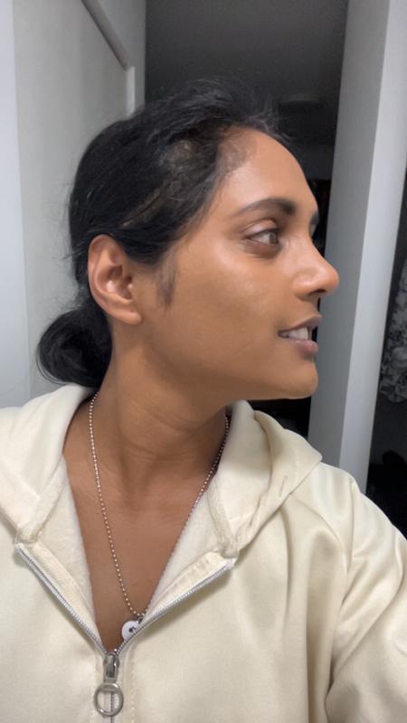 Before / after covering spots