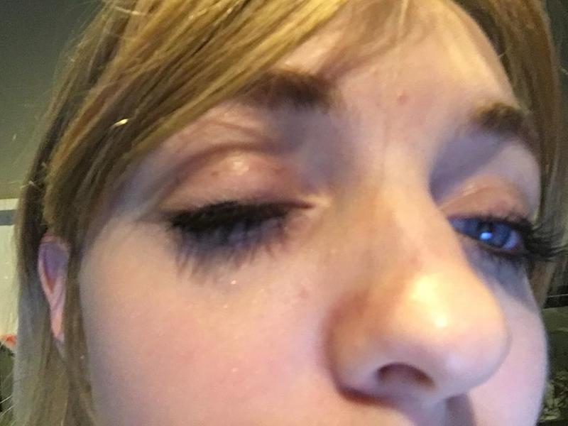 more transfer on my other eye