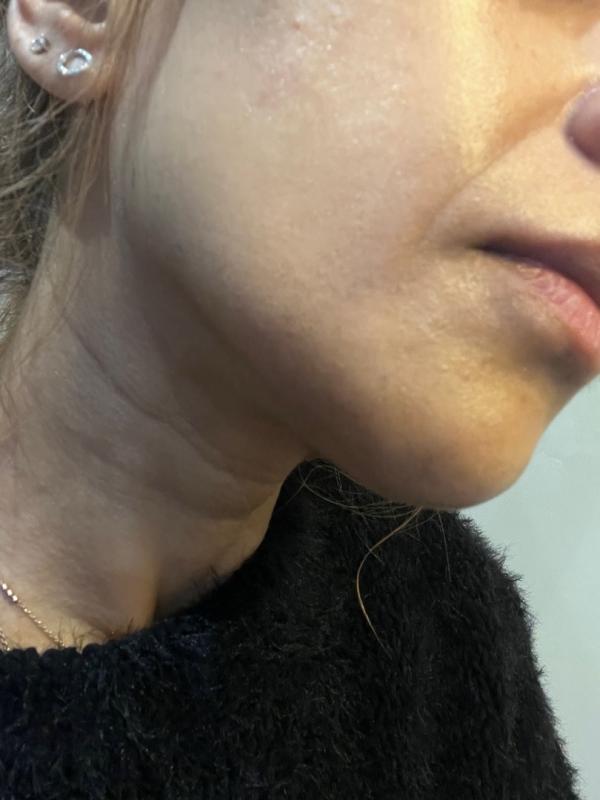 Customer carousel item 3.