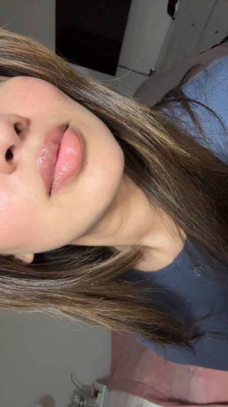 Customer carousel item 11.