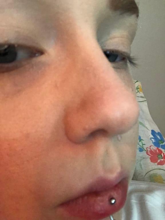 2 layers on nose with concealer