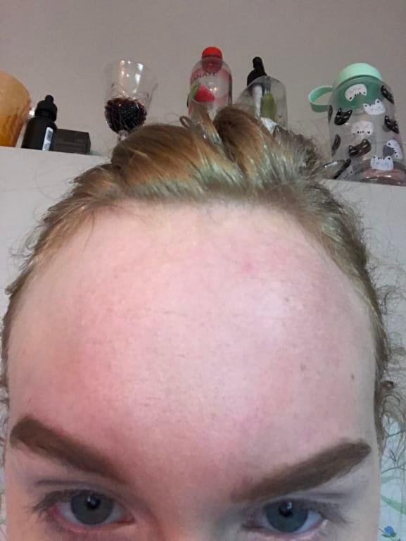 Two layers on forehead