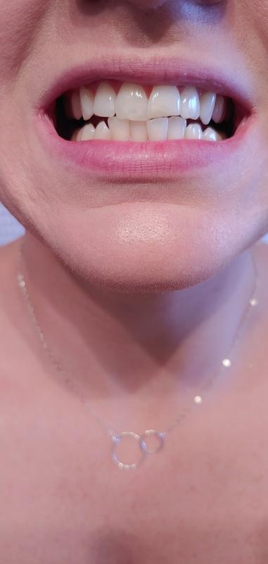 White teeth no more yellow tint!