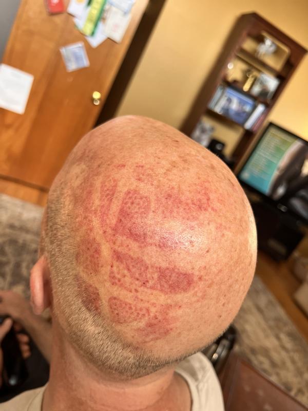 Photo submitted with review of product