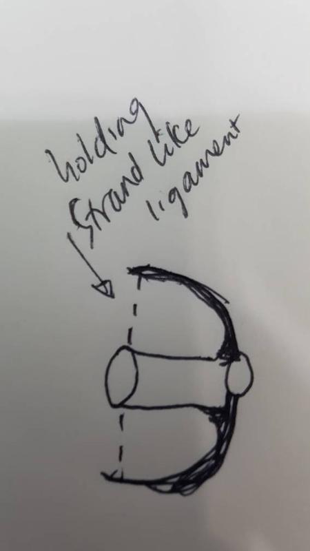 suggest this design to prevent flipping