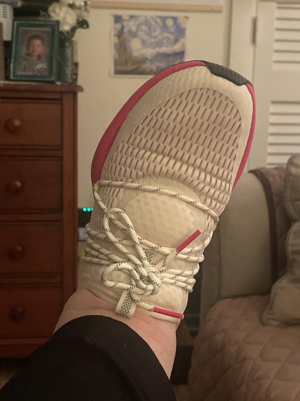 The foot that gives me the most issues