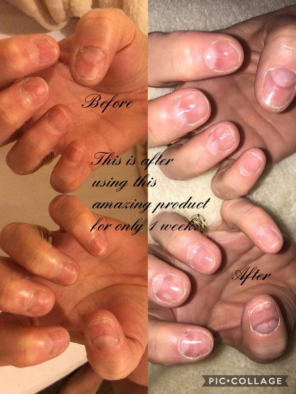 Nailgrowth Miracle | Sally Hansen