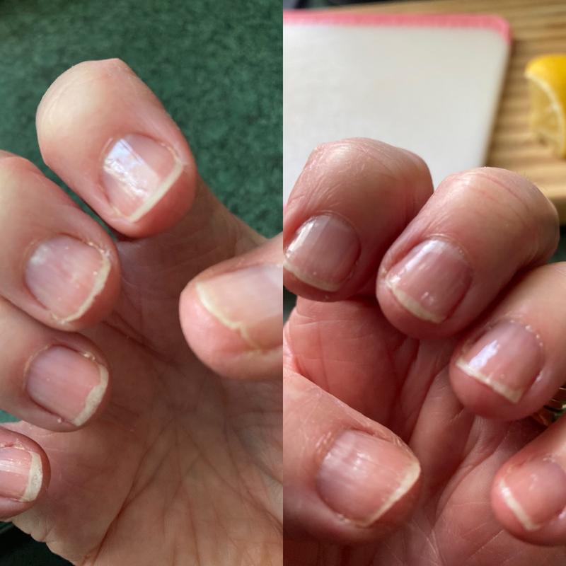 Sally Hansen Nailgrowth Miracle Serum™ | Sally Hansen