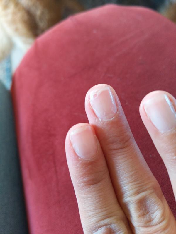 What exactly are these white spots on my nails? : r/longnaturalnails