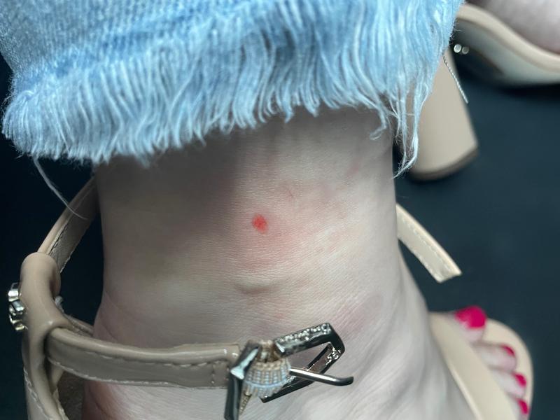 Wear time: 30 minutes. Skin: VERY RAW