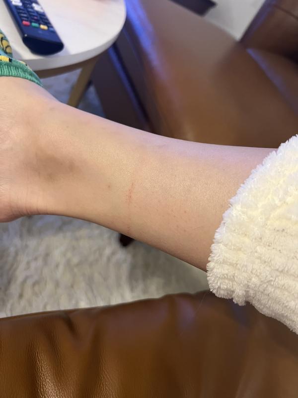 Price I paid for these pretty boots