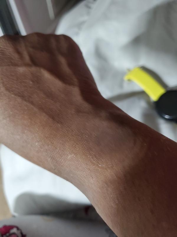 It has left a circle on my arm and can get rid of it