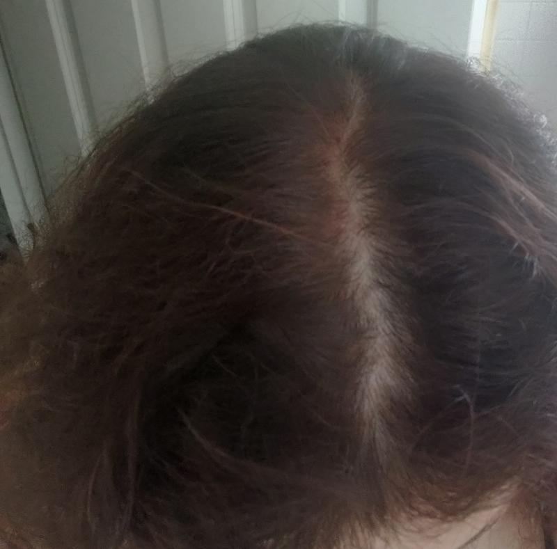 King Soopers Schwarzkopf Simply Color 5 65 Truffle Brown Hair Color Kit 1 Ct