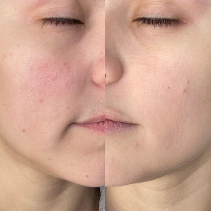 dr brandt c scription