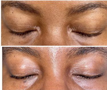first aid beauty retinol eye cream reddit