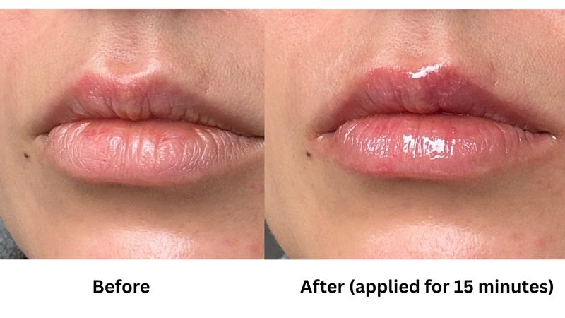 lipo c injection before and after stomach Dr Dennis Gross Skincare Lip Ornament Kit
