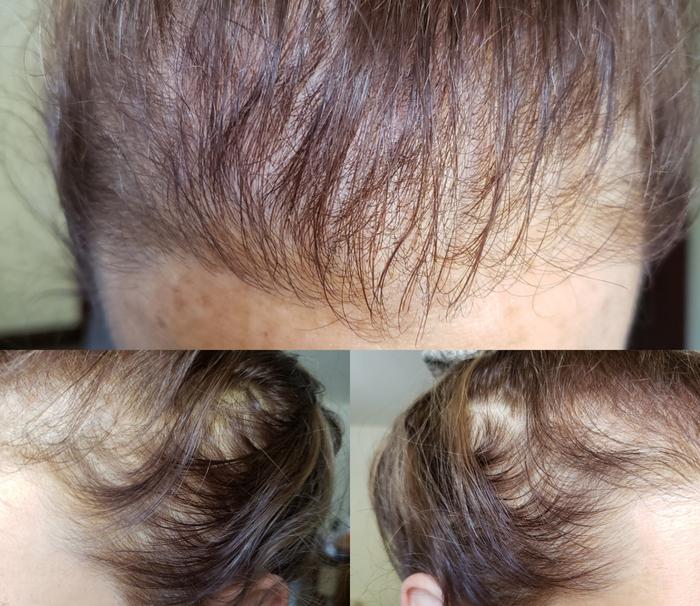 ordinary multi peptide serum hair