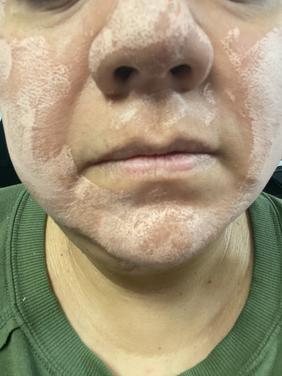 Instant Detox Mask - Caudalie  Sephora