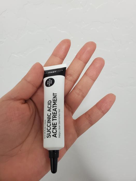 succinic acid acne treatment