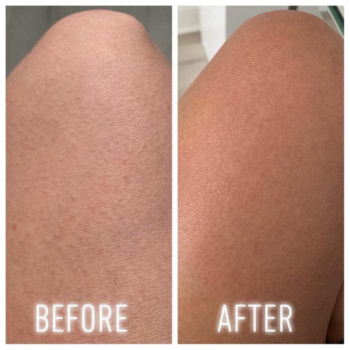 the bump eraser body scrub